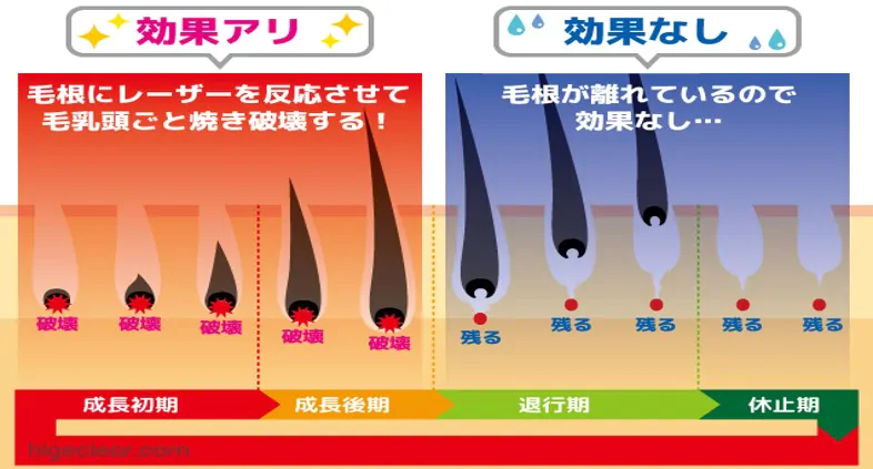 医療脱毛の毛周期について