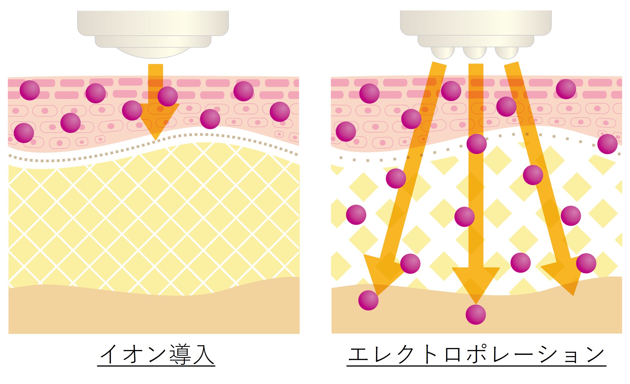 エレクトロポレーションとは